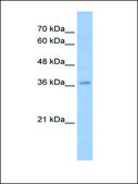 Anti-MyB antibody produced in rabbit affinity isolated antibody