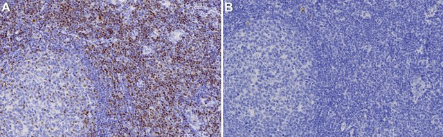 Anti-TCF7/TCF1 Antibody, clone 1H9 ZooMAb&#174; Rabbit Monoclonal recombinant, expressed in HEK 293 cells