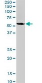 Monoclonal Anti-SPAST antibody produced in mouse clone 2F5, purified immunoglobulin, buffered aqueous solution