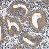 Anti-PPP2R1B antibody produced in rabbit Prestige Antibodies&#174; Powered by Atlas Antibodies, affinity isolated antibody, buffered aqueous glycerol solution