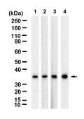 Anti-Tropomyosin Antibody, clone 1C5 ZooMAb&#174; Rabbit Monoclonal recombinant, expressed in HEK 293 cells