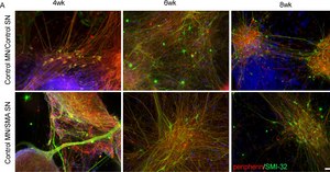 Anti-Peripherin Antibody serum, Chemicon&#174;