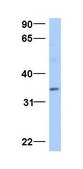 Anti-ATG5 antibody produced in rabbit affinity isolated antibody