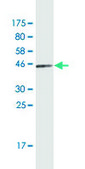 Monoclonal Anti-FTL antibody produced in mouse clone X1, purified immunoglobulin, buffered aqueous solution