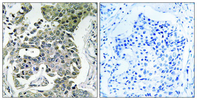 Anti-PPP2R1B antibody produced in rabbit affinity isolated antibody