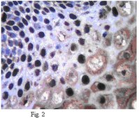 Anti-Twist1 (Twist-related protein 1) Antibody from rabbit, purified by affinity chromatography
