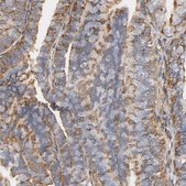 Anti-IFITM3 antibody produced in rabbit Prestige Antibodies&#174; Powered by Atlas Antibodies, affinity isolated antibody, buffered aqueous glycerol solution