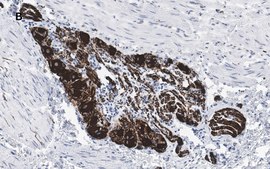 Anti-Peripherin Antibody, clone 1D4, ZooMAb&#174; Rabbit Monoclonal recombinant, expressed in HEK 293 cells