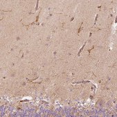 Anti-FSCN1 antibody produced in rabbit Prestige Antibodies&#174; Powered by Atlas Antibodies, affinity isolated antibody