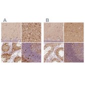 Anti-FSCN1 antibody produced in rabbit Prestige Antibodies&#174; Powered by Atlas Antibodies, affinity isolated antibody, buffered aqueous glycerol solution
