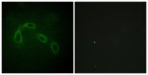 Anti-PAK1 antibody produced in rabbit affinity isolated antibody