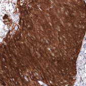 Anti-NCAM1 antibody produced in mouse Prestige Antibodies&#174; Powered by Atlas Antibodies, clone CL12732, purified by using Protein A, buffered aqueous glycerol solution