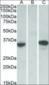 Anti-CMA1 antibody produced in goat affinity isolated antibody, buffered aqueous solution