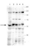 Anti-PPAT antibody produced in rabbit affinity isolated antibody