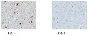 Anti-Tet2 Antibody from rabbit, purified by affinity chromatography