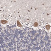 Anti-NF2 antibody produced in rabbit Prestige Antibodies&#174; Powered by Atlas Antibodies, affinity isolated antibody, buffered aqueous glycerol solution