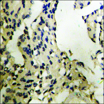 Anti-phospho-MEF2C (pSer396) antibody produced in rabbit affinity isolated antibody
