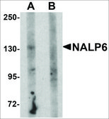 Anti-NALP6 antibody produced in rabbit affinity isolated antibody, buffered aqueous solution