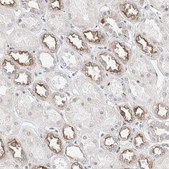 Anti-KCNJ1 antibody produced in rabbit Prestige Antibodies® Powered by Atlas Antibodies, affinity isolated antibody, buffered aqueous glycerol solution
