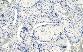 Anti-LIN28B Antibody, clone 1H17 ZooMAb&#174; Rabbit Monoclonal recombinant, expressed in HEK 293 cells