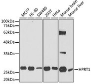 Anti-HPRT1 antibody produced in rabbit