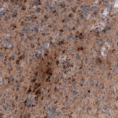 Monoclonal Anti-CHI3L1 antibody produced in mouse Prestige Antibodies® Powered by Atlas Antibodies, clone CL12241, purified immunoglobulin, buffered aqueous glycerol solution