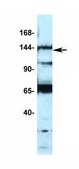Anti-TRPM4 antibody produced in rabbit affinity isolated antibody