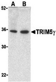 Anti-TRIM5 gamma antibody produced in rabbit affinity isolated antibody