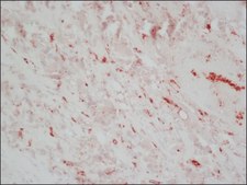 Anti-Cathepsin D antibody, Mouse monoclonal clone CTD-19, purified from hybridoma cell culture