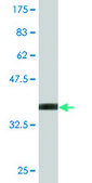 Monoclonal Anti-MARK2 antibody produced in mouse clone 3C5, purified immunoglobulin, buffered aqueous solution