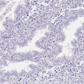 Anti-HDGFL1 antibody produced in rabbit Prestige Antibodies&#174; Powered by Atlas Antibodies, affinity isolated antibody, buffered aqueous glycerol solution