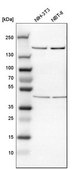 Anti-ROCK1 antibody produced in rabbit Prestige Antibodies&#174; Powered by Atlas Antibodies, affinity isolated antibody, buffered aqueous glycerol solution
