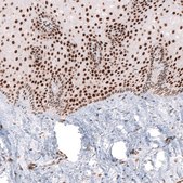 Monoclonal Anti-CUX1 antibody produced in mouse Prestige Antibodies&#174; Powered by Atlas Antibodies, clone CL5275, purified immunoglobulin, buffered aqueous glycerol solution