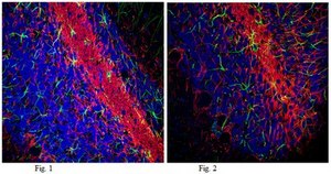 Anti-Neurofilament 200kDa Antibody, clone NE14, Alexa Fluor&#8482; 555 Conjugate clone NE14, from mouse, ALEXA FLUOR&#8482; 555