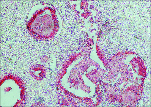 Anti-Rabbit IgG (whole molecule)–Alkaline Phosphatase antibody produced in goat affinity isolated antibody, buffered aqueous solution