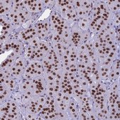 Anti-PARP1 antibody produced in rabbit Prestige Antibodies&#174; Powered by Atlas Antibodies, affinity isolated antibody, buffered aqueous glycerol solution