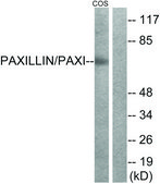 Anti-Paxillin antibody produced in rabbit affinity isolated antibody