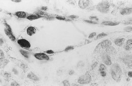 Anti-DNA Antibody, single stranded specific, clone F7-26 clone F7-26, Chemicon&#174;, from mouse