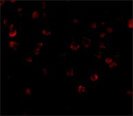 Anti-ADAP (ab2) antibody produced in rabbit affinity isolated antibody, buffered aqueous solution