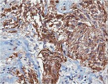 Anti-Nestin, Human Antibody serum, from rabbit