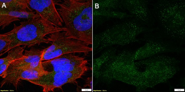 Anti-METTL4 Antibody, clone 2I6 ZooMAb&#174; Rabbit Monoclonal recombinant, expressed in HEK 293 cells