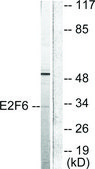Anti-E2F6 antibody produced in rabbit affinity isolated antibody