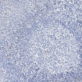 Anti-TGM4 antibody produced in rabbit Prestige Antibodies&#174; Powered by Atlas Antibodies, affinity isolated antibody, buffered aqueous glycerol solution