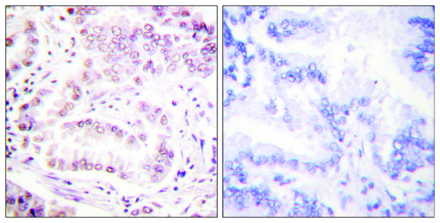 Anti-Histone H3 (Acetyl-Lys27) antibody produced in rabbit affinity isolated antibody