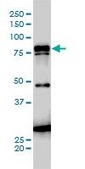 Monoclonal Anti-JUP antibody produced in mouse clone 2G9, purified immunoglobulin, buffered aqueous solution
