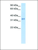 Anti-CA4 (AB1) antibody produced in rabbit affinity isolated antibody