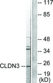Anti-Claudin 3 antibody produced in rabbit affinity isolated antibody