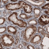 Monoclonal Anti-ACAA1 antibody produced in mouse Prestige Antibodies&#174; Powered by Atlas Antibodies, clone CL2660, purified immunoglobulin, buffered aqueous glycerol solution