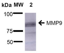 Monoclonal Anti-Copper Transporting Atpase 1 - Rpe antibody produced in mouse clone S60-4, purified immunoglobulin