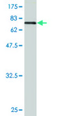 Monoclonal Anti-ENO1 antibody produced in mouse clone 3C8, purified immunoglobulin, buffered aqueous solution